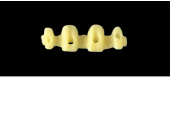 Cod.E18 f Upper Anterior: 10x  hollow pontics blocks-frames, (12-22), carved to fit into wax veneers Cod.E18Upper Anterior, MEDIUM,not arched, (12-22), for porcelain pressed to metal bridgework